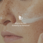 Why is my skin suddenly so sensitive?