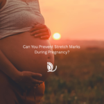 Can You Prevent Stretch Marks During Pregnancy?